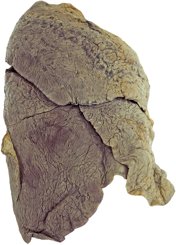 Clinical Anatomy | Atlas | Right Lung Lateral View