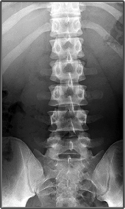 Clinical Anatomy | Radiology | AP Back