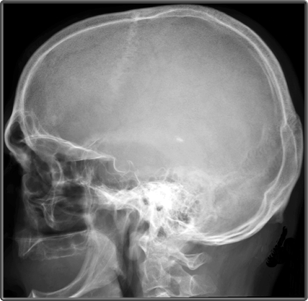 Clinical Anatomy | Radiology | Lateral Skull